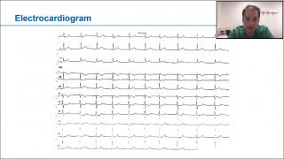 Image from webinar on Case Studies presenting as ACS