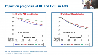 Image from webinar on Challenging Clinical Situations in ACS